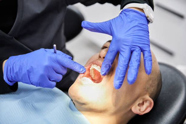 Best Emergency Dentist for Knocked-Out Tooth in Carthage, NC