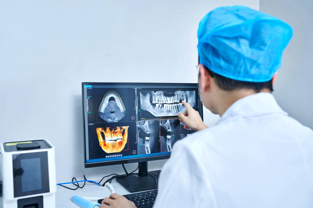Best Emergency Root Canal Treatment in Carthage, NC