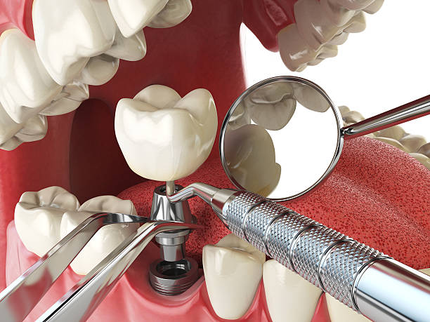 Best Emergency Dentist for Special Needs Patients in Carthage, NC